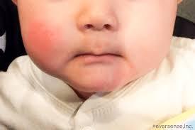 が 赤ちゃん 赤い ほっぺ 赤ちゃんの顔が赤い！熱はないけど…大丈夫？病気？暑いだけ？